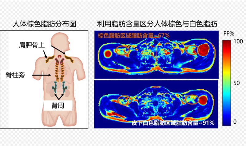 1164人核磁研究发现：内脏脂肪越多大脑越老，关键竟在肌肉比 - 新龙谷信息港