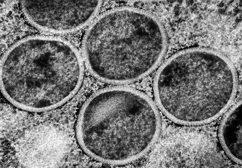 研究表明猴痘病毒一直在进化(图1)